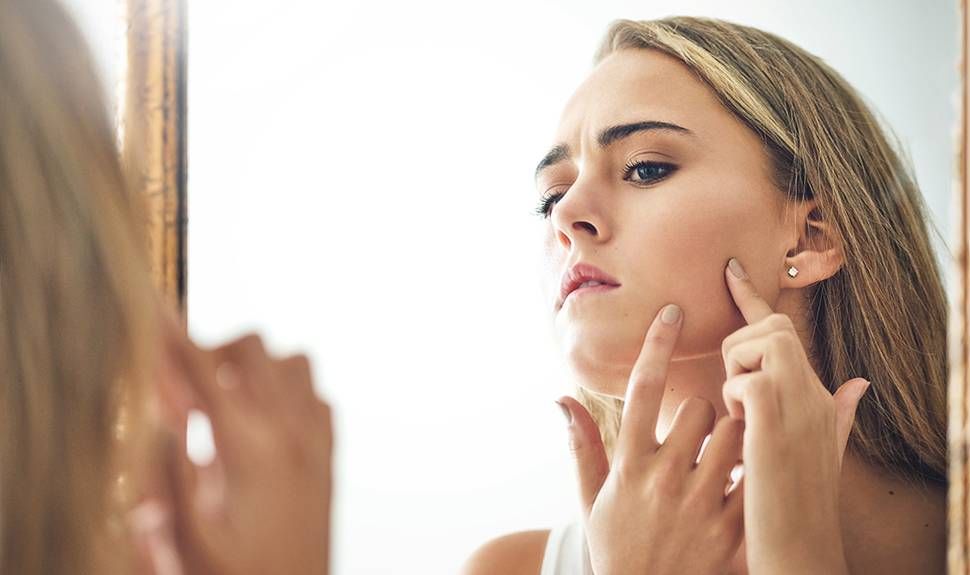 Hormonel Akne Neden Oluşur?