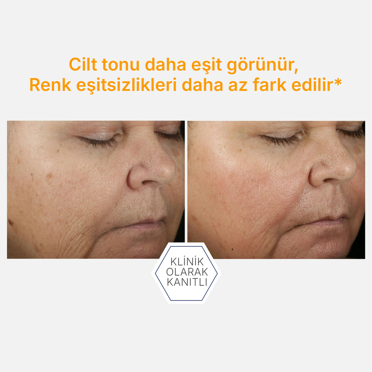 NeoStrata Enlighten %15 C Vitamini + PHA Aydınlatıcı Konsantre Serum