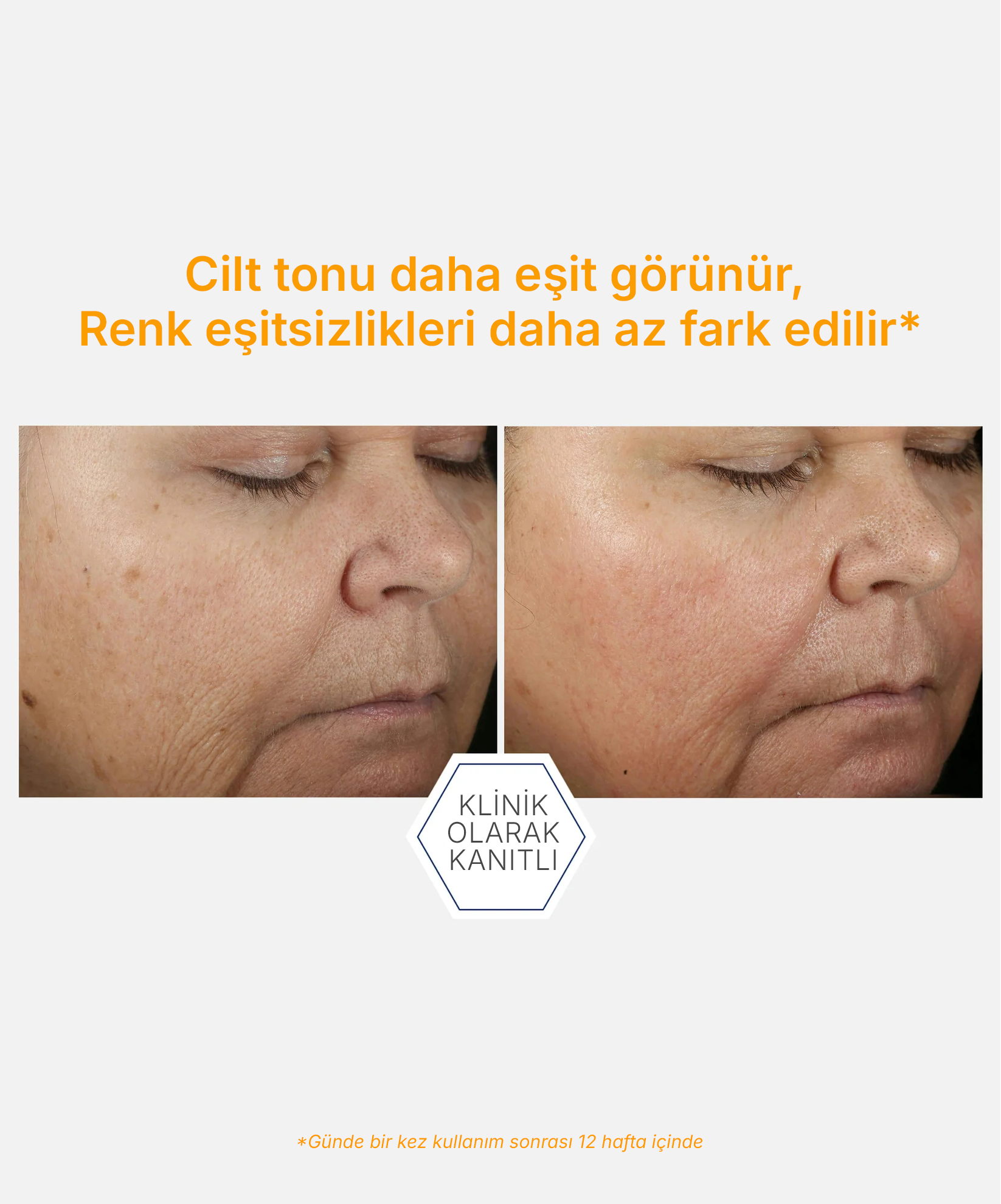 NeoStrata Enlighten %15 C Vitamini + PHA Aydınlatıcı Konsantre Serum