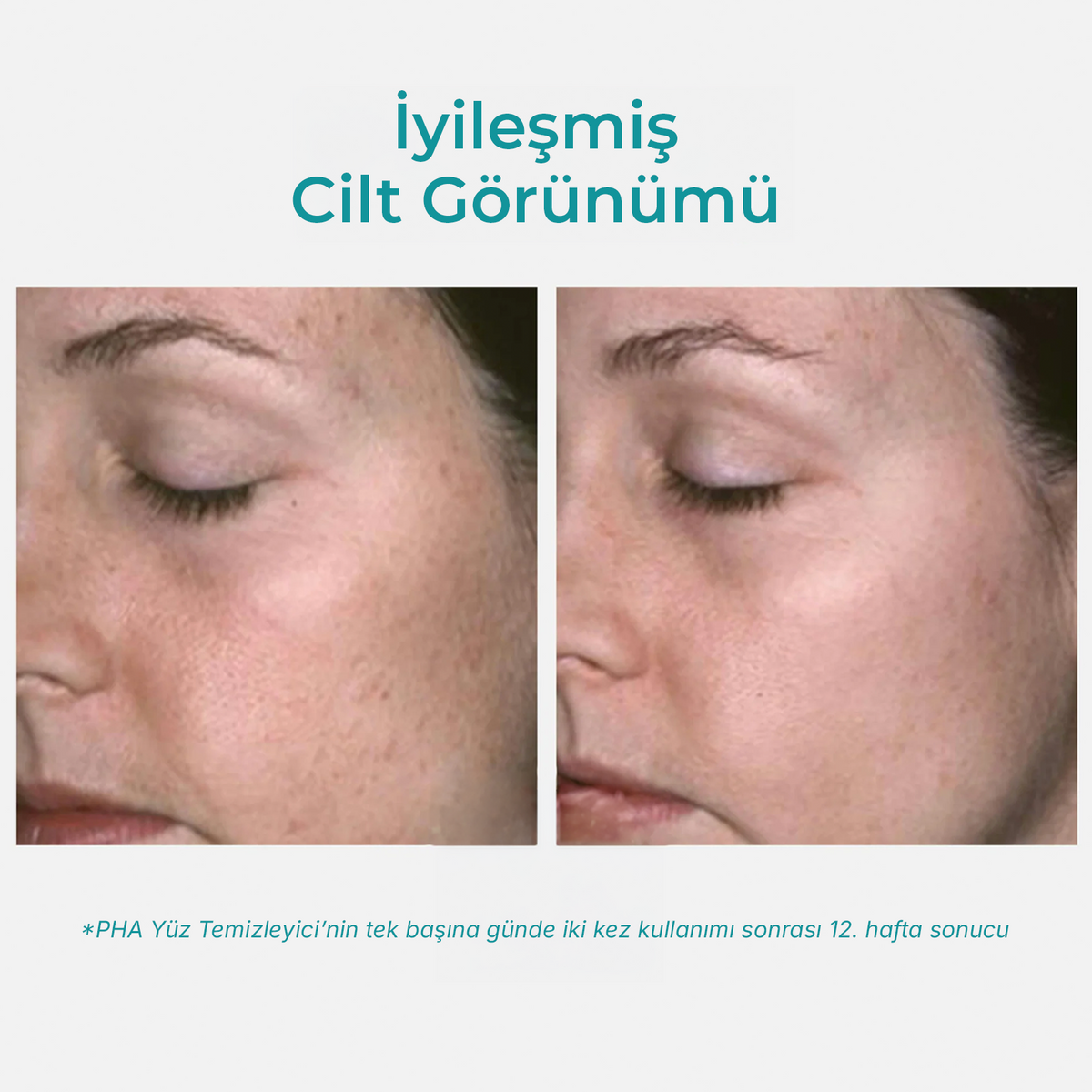 NeoStrata Restore PHA Yüz Temizleyici